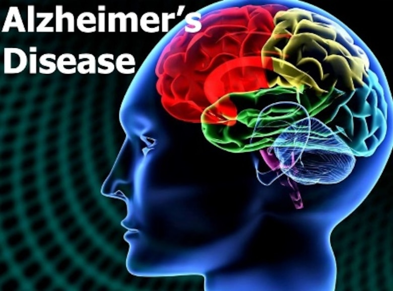 Alzheimer's Disease