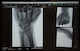 Image of the skeletal structure of a patient’s hand displayed on the monitor of a mobile X-ray machine, Aug. 22, 2017, at the Orthopedic Hand Clinic, David Grant U.S. Air Force Medical Center, Travis Air force Base. Calif.  DGMC's Orthopedic and Podiatry Clinics are comprised of dedicated and compassionate professionals who specialize in the comprehensive care of patients with bone and joint disorders of the extremities. (U.S. Air Force photo/ Heide Couch)