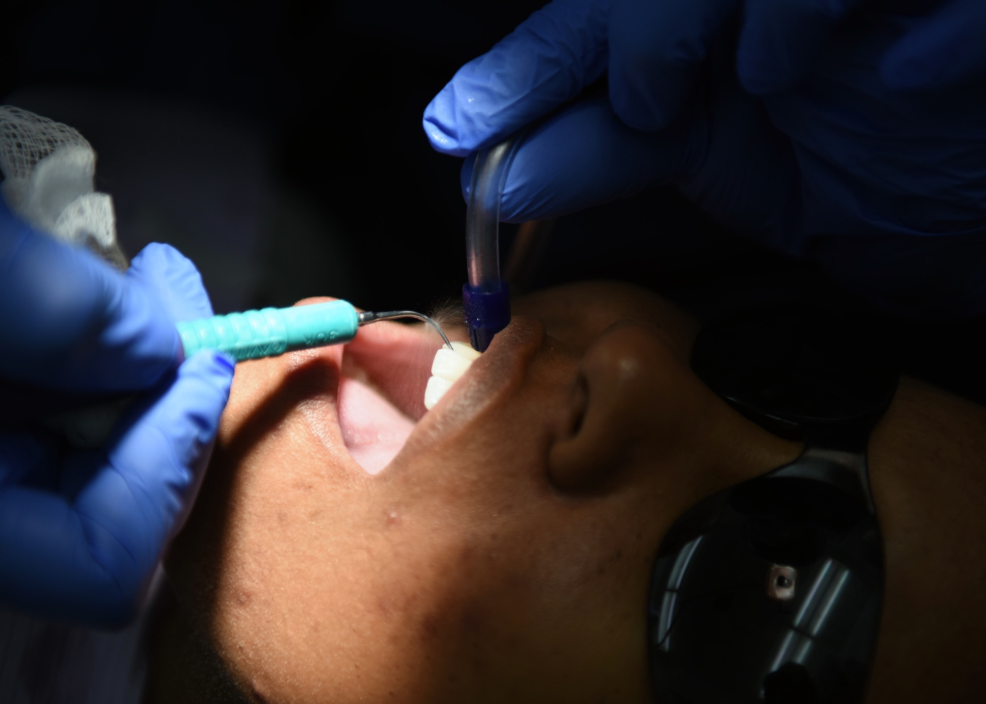 Tech. Sgt. Stephanie Janney, 344th Training Squadron NCOIC of information management, has her teeth cleaned by Aleshiea Johnson, 30th Medical Operations Squadron registered dental assistant, Oct. 18, 2017, Vandenberg Air Force Base, Calif. The dental flight, within the 30th MDOS, is currently celebrating October's National Dental Hygiene Month. The month aims to help raise public awareness on the topic of good oral health and focuses on three main components – brushing teeth daily, flossing, and smart nutrition. (U.S. Air Force photo by Senior Airman Kyla Gifford/Released)