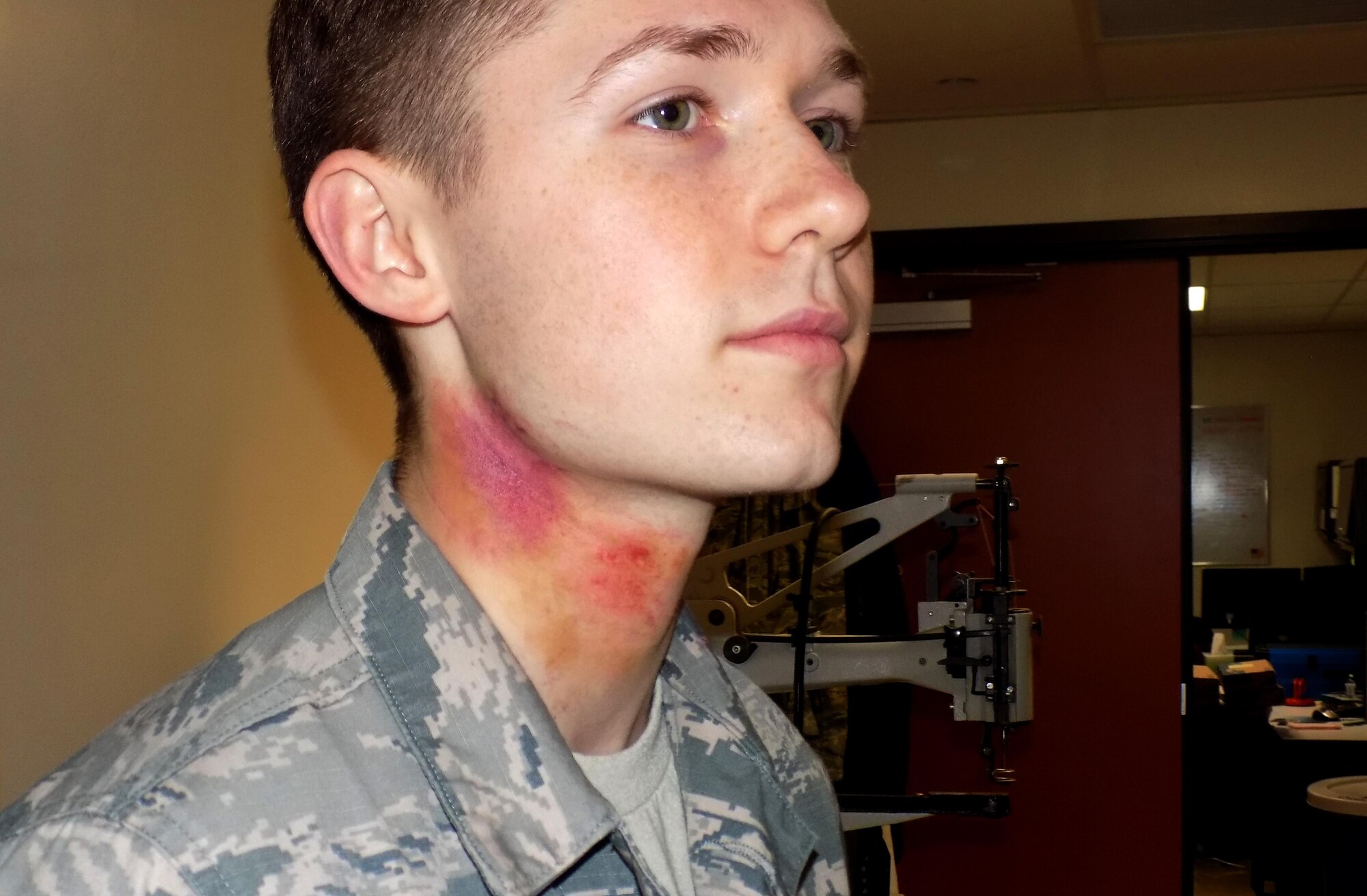 Airman 1st Class Christian Graham, 60th Diagnostics and Therapeutics Squadron medical lab technician, shows the bruises on his neck that were put on him for a domestic violence awareness experience at Travis Force Base, Calif., on Oct. 24, 2017. The month of October is recognized as National Domestic Violence Awareness Month. (U.S. Air Force photo by Latrise Muchison)