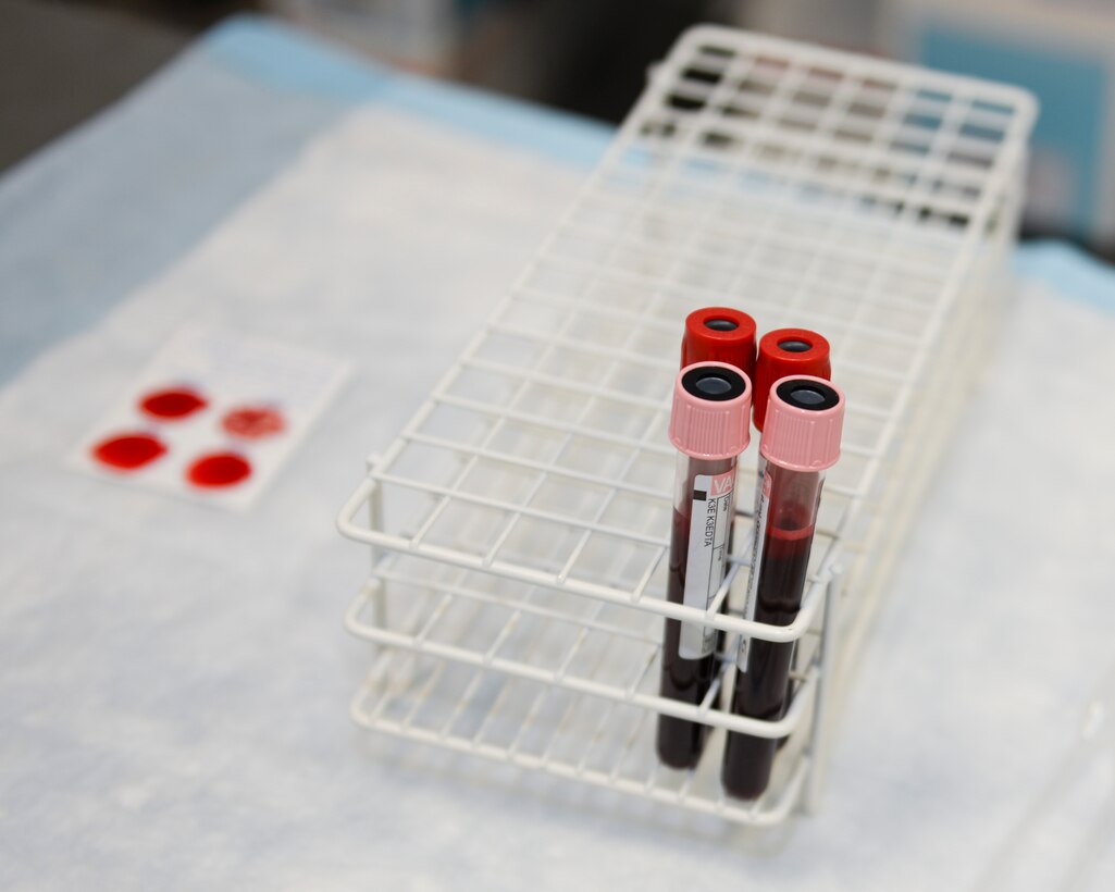 Viles of blood collected during an apheresis donation await testing to be screened for viability at Al Udeid, Air Base, Qatar, Aug. 23, 2017.