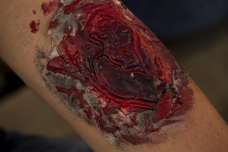 A role player displays a simulated wound during the Anti-Terrorism/Force Protection Exercise Lethal Breeze, aboard Marine Corps Base Hawaii, (MCBH) Sept. 12, 2017. The exercise combined multiple agencies, on and off the installation, to respond to a simulated attack, mass casualty scenario, and an environmental oil spill. Exercise Lethal Breeze provided hands-on experience and training to prepare MCBH to protect personnel, facilities, and other assets from all threats and hazards. (U.S. Marine Corps Photo by Sgt. Alex Kouns)(U.S. Marine Corps Photo by Sgt. Alex Kouns)