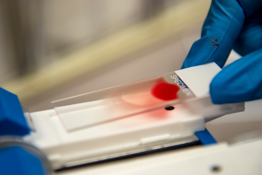 Victoria Stack, 23d Medical Support Squadron medical technologist, prepares a slides to check for red blood cell abnormalities, Aug. 18, 2017, at Moody Air Force Base, Ga. Moody’s lab technicians process blood to check for a variety of variances from infections to cancer. (U.S. Air Force photo by Airman 1st Class Erick Requadt)