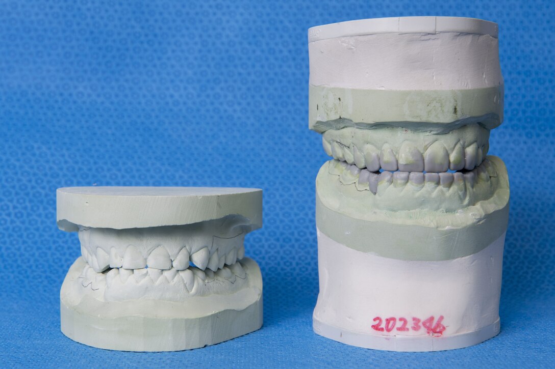 Dental molds sit side by side for comparison, Jan. 29, 2018, at Yokota Air Base, Japan.