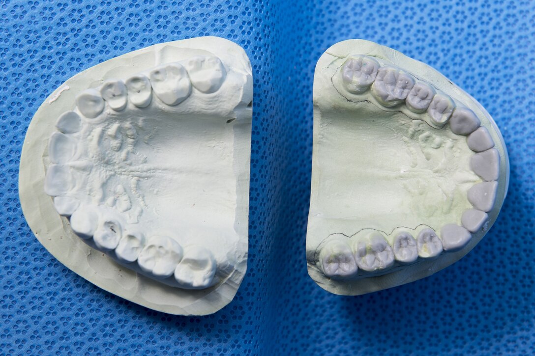 A mold of the original top row of teeth, (left), sits for comparison and approval against a newly made set, Jan. 29, 2018, at Yokota Air Base, Japan.