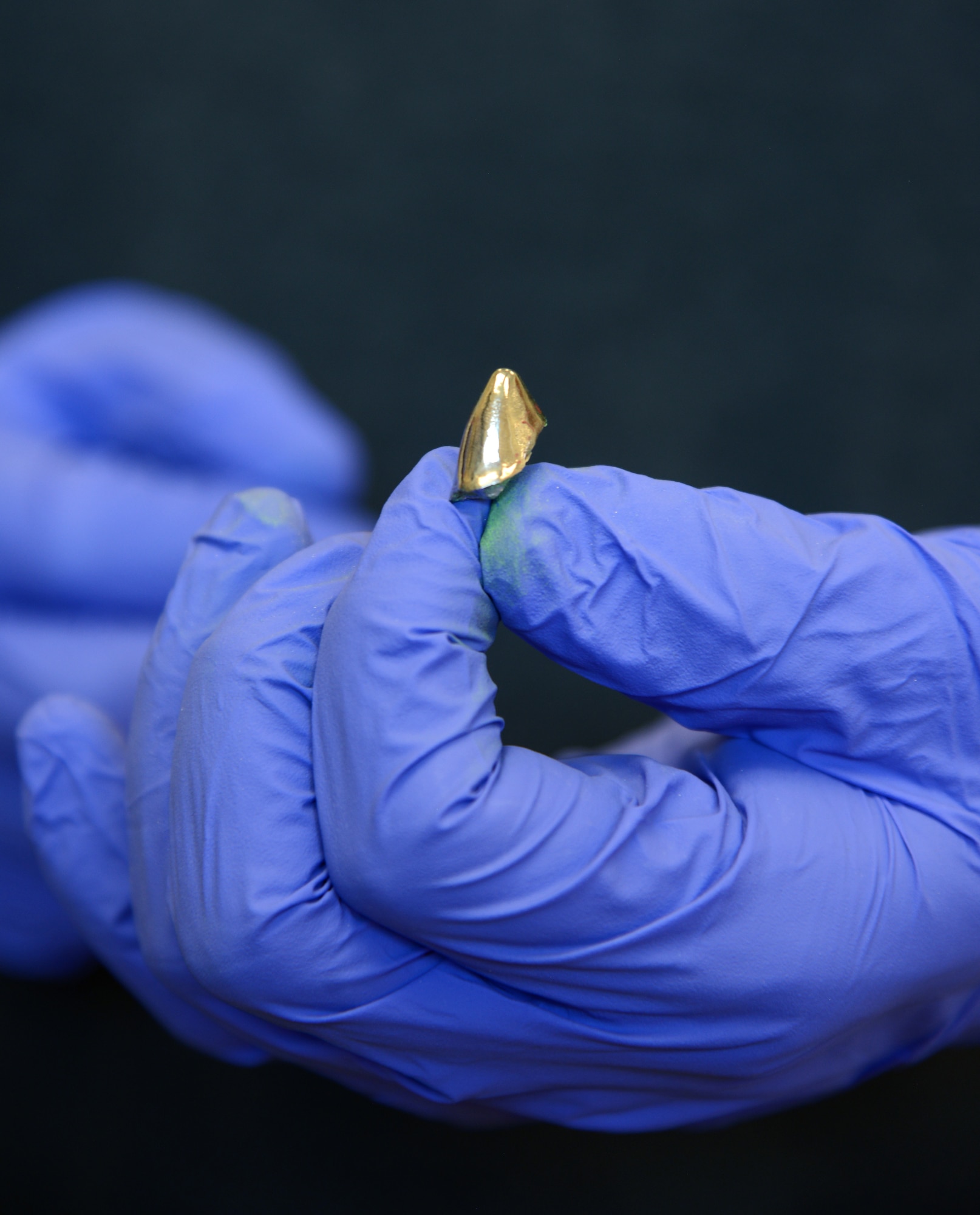 MWD Aruba's new silver alloy crown is prepped and ready to be affixed to his tooth.