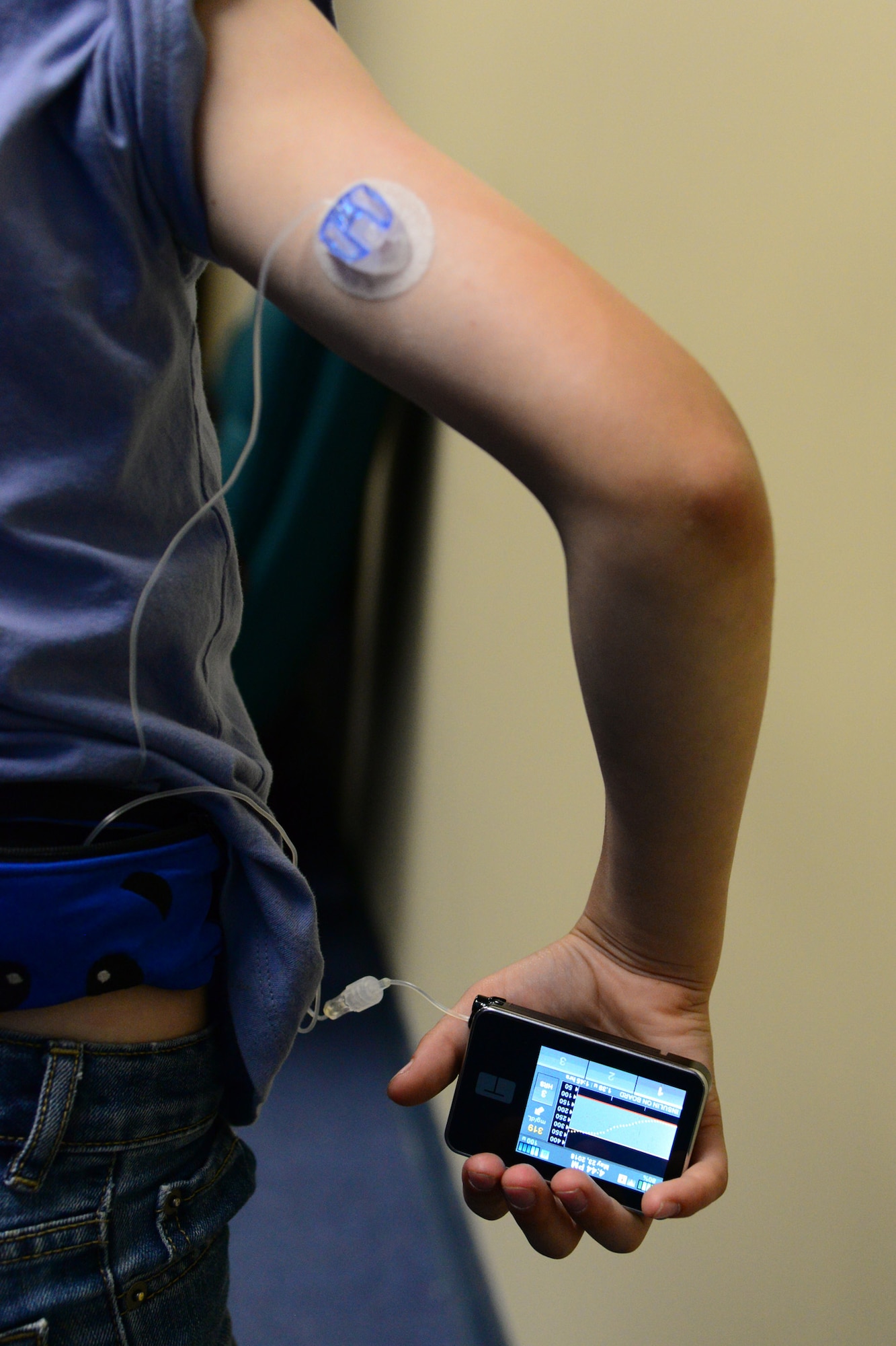 Ziggy Richards poses for a photo to display his insulin pump May 23, 2018, at Malmstrom Air Force Base, Mont.
