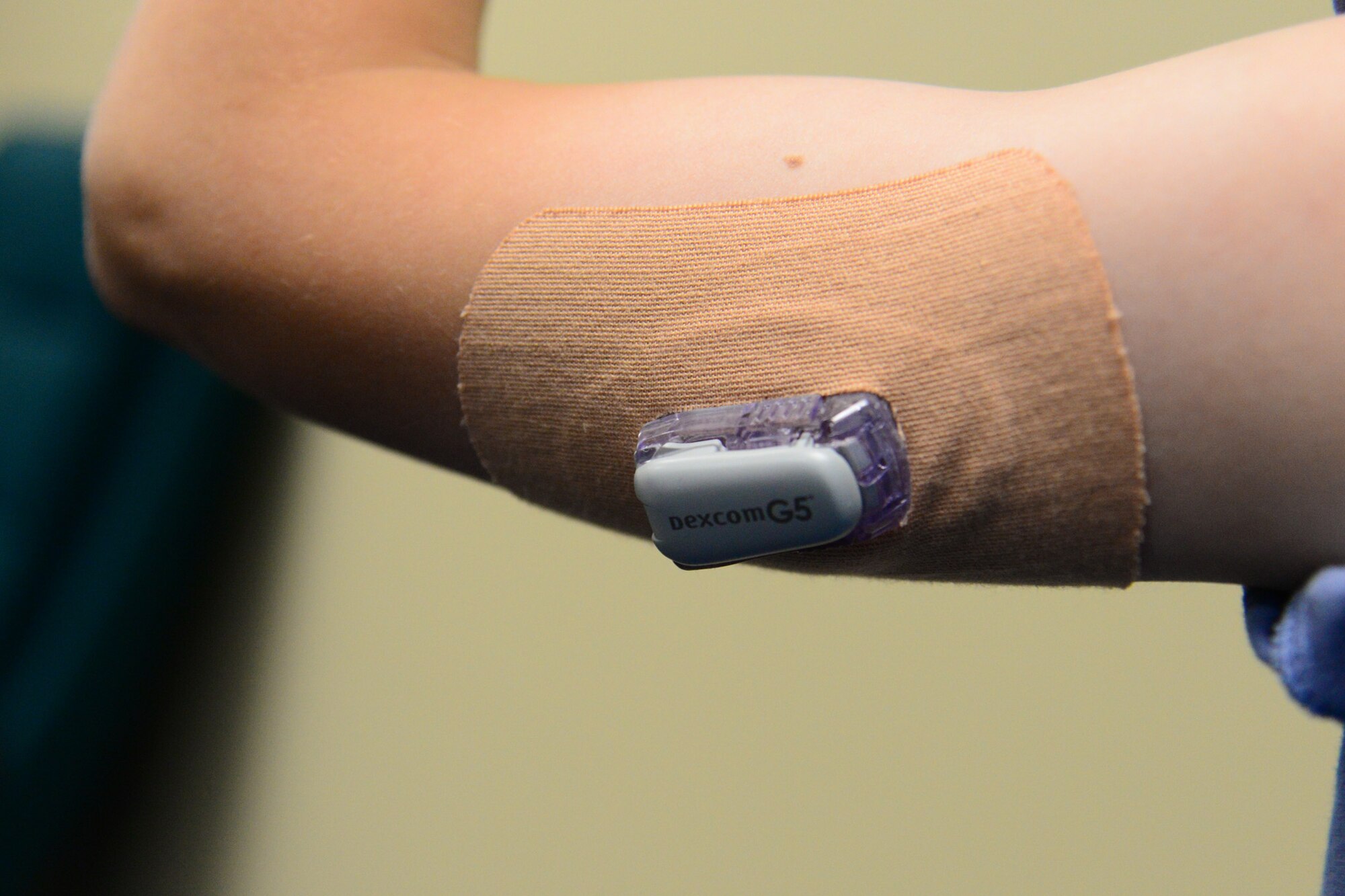 Ziggy Richards poses for a photo to display his Continuous Glucose Monitor May 23, 2018, at Malmstrom Air Force Base, Mont.