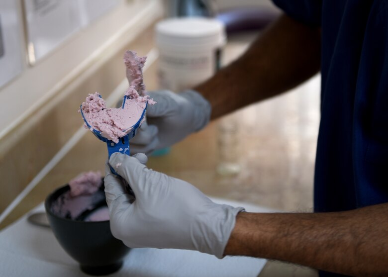 The dental clinic creates mouth guards for members to prevent injuries to the teeth and mouth during high intensity activities.