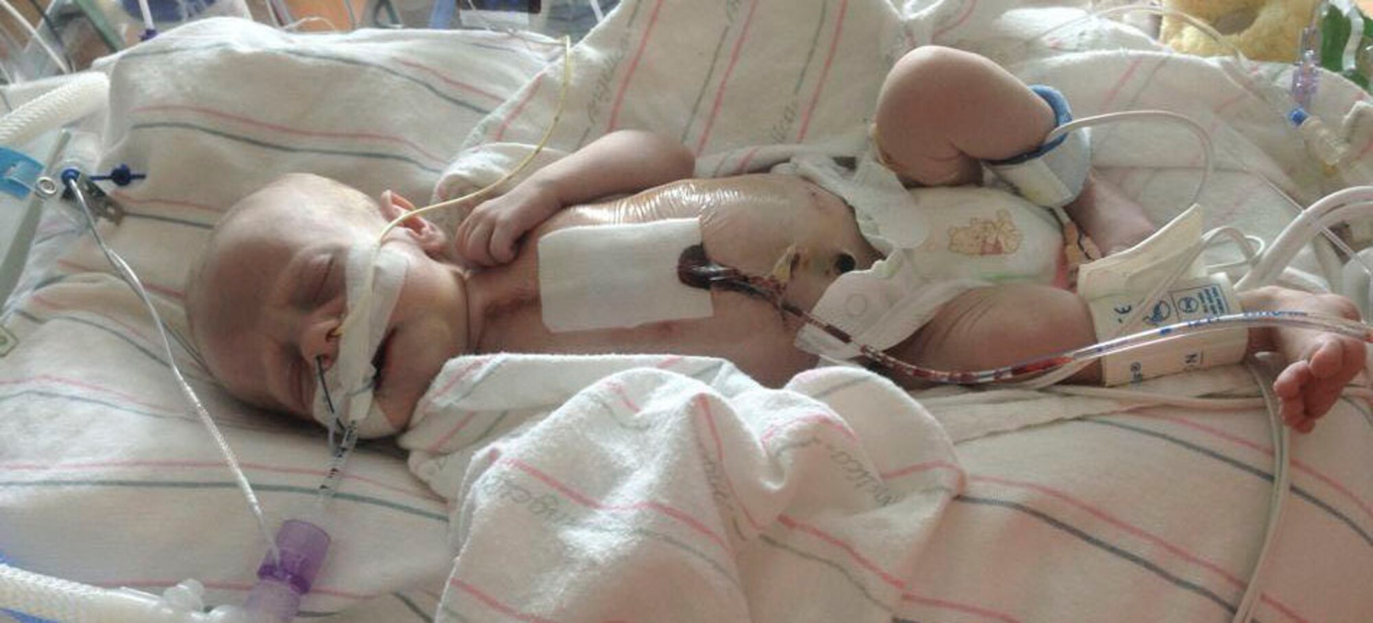 Jack rests in hospital