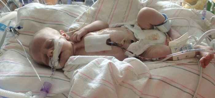 Jack rests in hospital