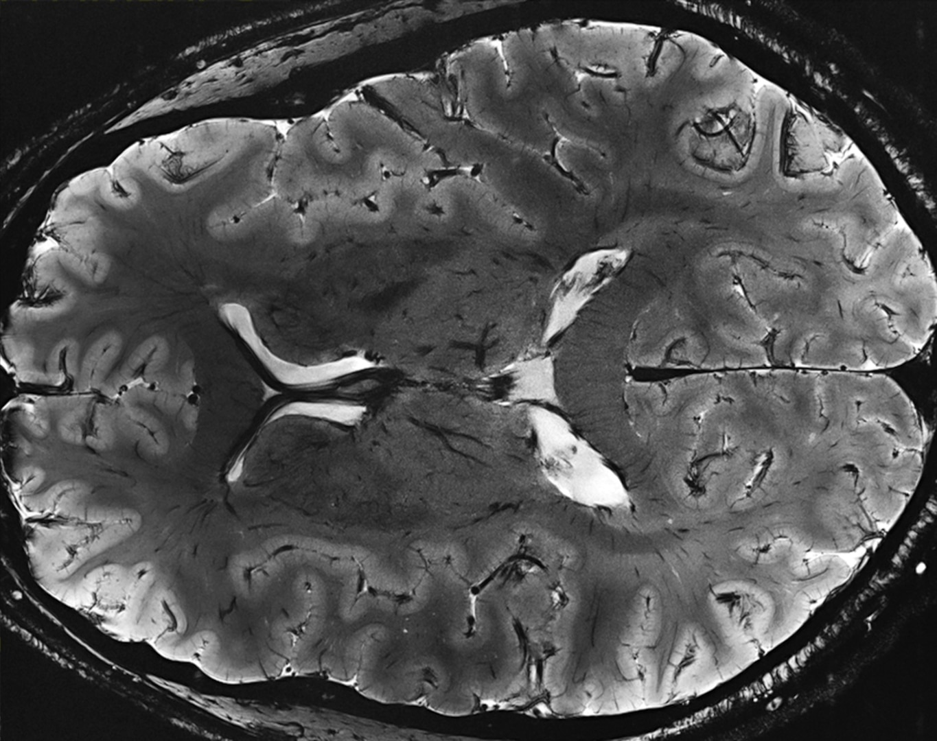 brain scan from a 7T MRI scanner