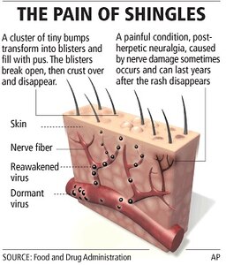 An earlier shingles vaccine was introduced in 2006, but that vaccine was for people 60 and older when it first came out, and only about 70 percent effective in offering full protection against the virus.