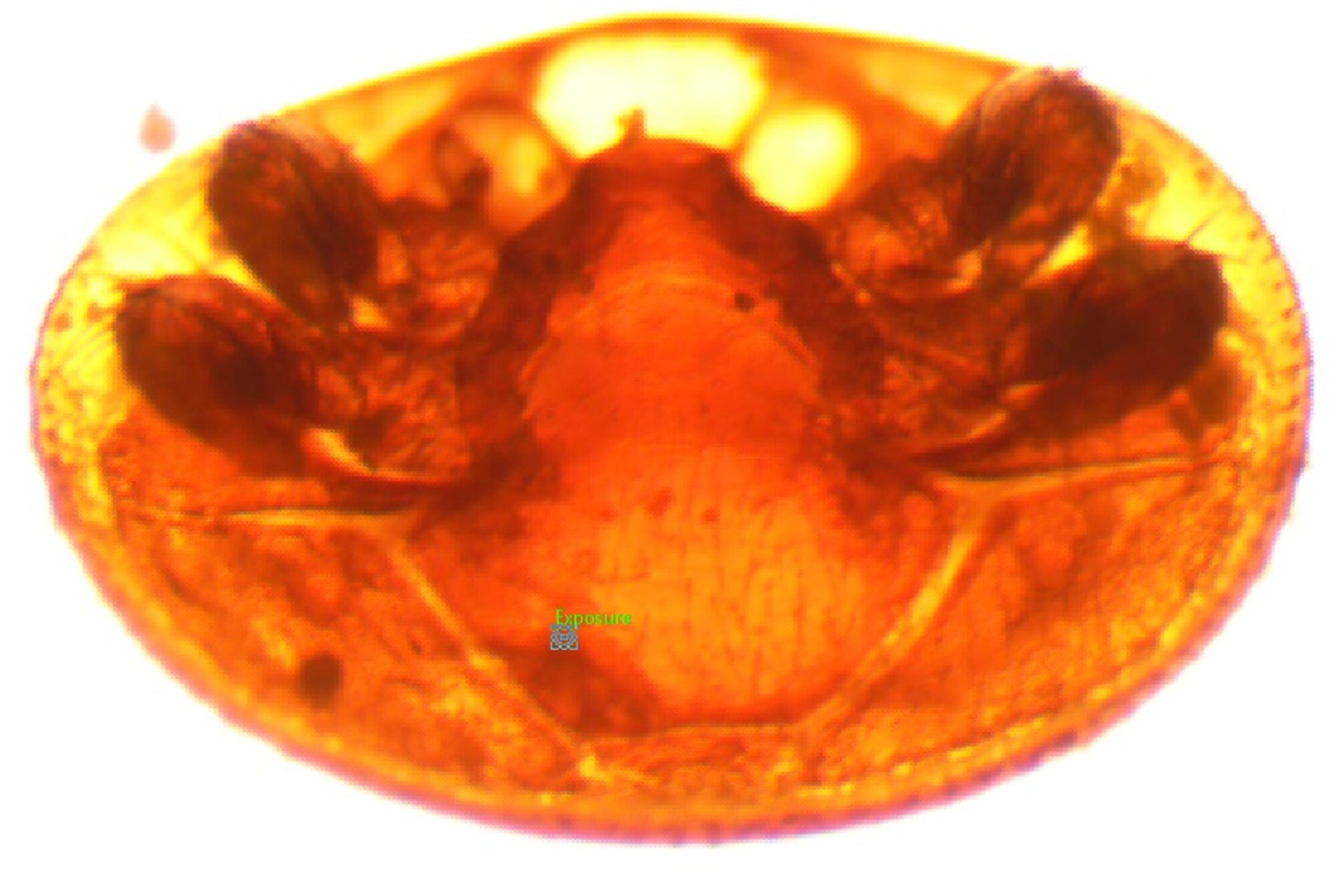A microscopic photo of a harmful varroa mite with its head and legs chewed off by a honey bee. (Courtesy photo)