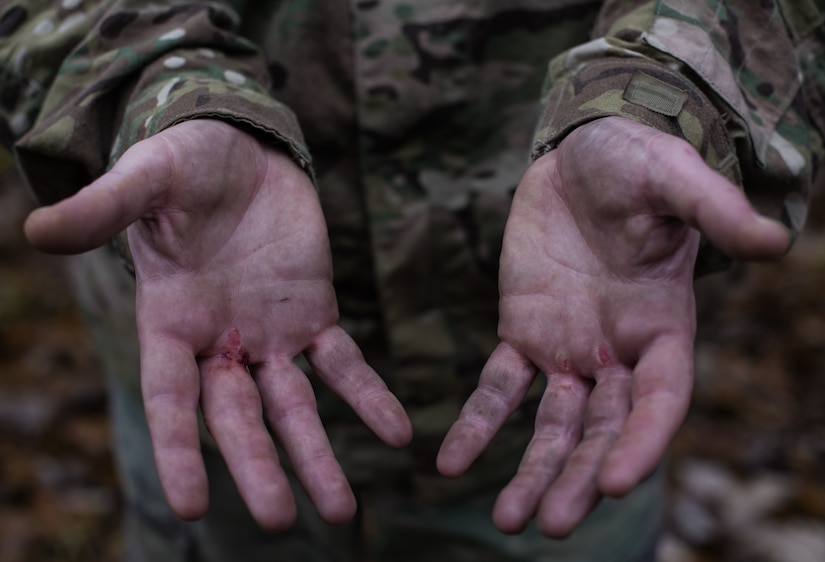 Sgt. 1st Class Mark Padifeld, 174th Infantry Brigade, 3rd Battalion, 314th Field Artillery Regiment fire support NCO observer and coach, shows his hands after the obstacle course during the 2018 Service Member of the Year Competition on Joint Base McGuire-Dix-Lakehurst, New Jersey, Nov. 6, 2018. U.S. Army Master Sgt. Juan Duque, Army Support Activity operation NCO, said the theme this year was to promote service members who can operate outside of their respective tasks within their sister services. (U.S. Air Force photo by Airman 1st Class Ariel Owings)