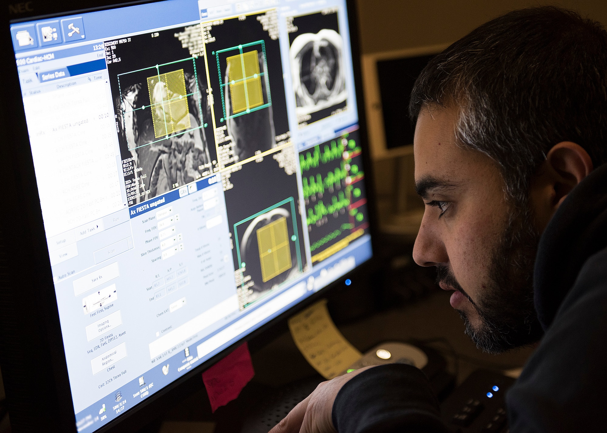 Marvin Perez, 59th Medical Wing cardiac magnetic resonance imaging technologist, observes a patient’s vitals during a scan at Wilford Hall Ambulatory Surgical Center, Joint Base San Antonio-Lackland, Texas. Cardiac MRI, which takes approximately 20-45 minutes, is a non-invasive assessment of the function and structure of the heart. (U.S. Air Force photo by Staff Sgt. Kevin Iinuma)