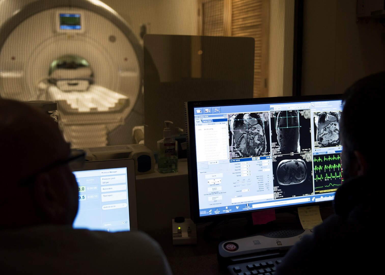 Cardiac magnetic resonance imaging technologists observe a patient during a cardiac MRI scan at Wilford Hall Ambulatory Surgical Center, Joint Base San Antonio-Lackland. Cardiac MRI, which takes approximately 20-45 minutes, is a non-invasive assessment of the function and structure of the heart.