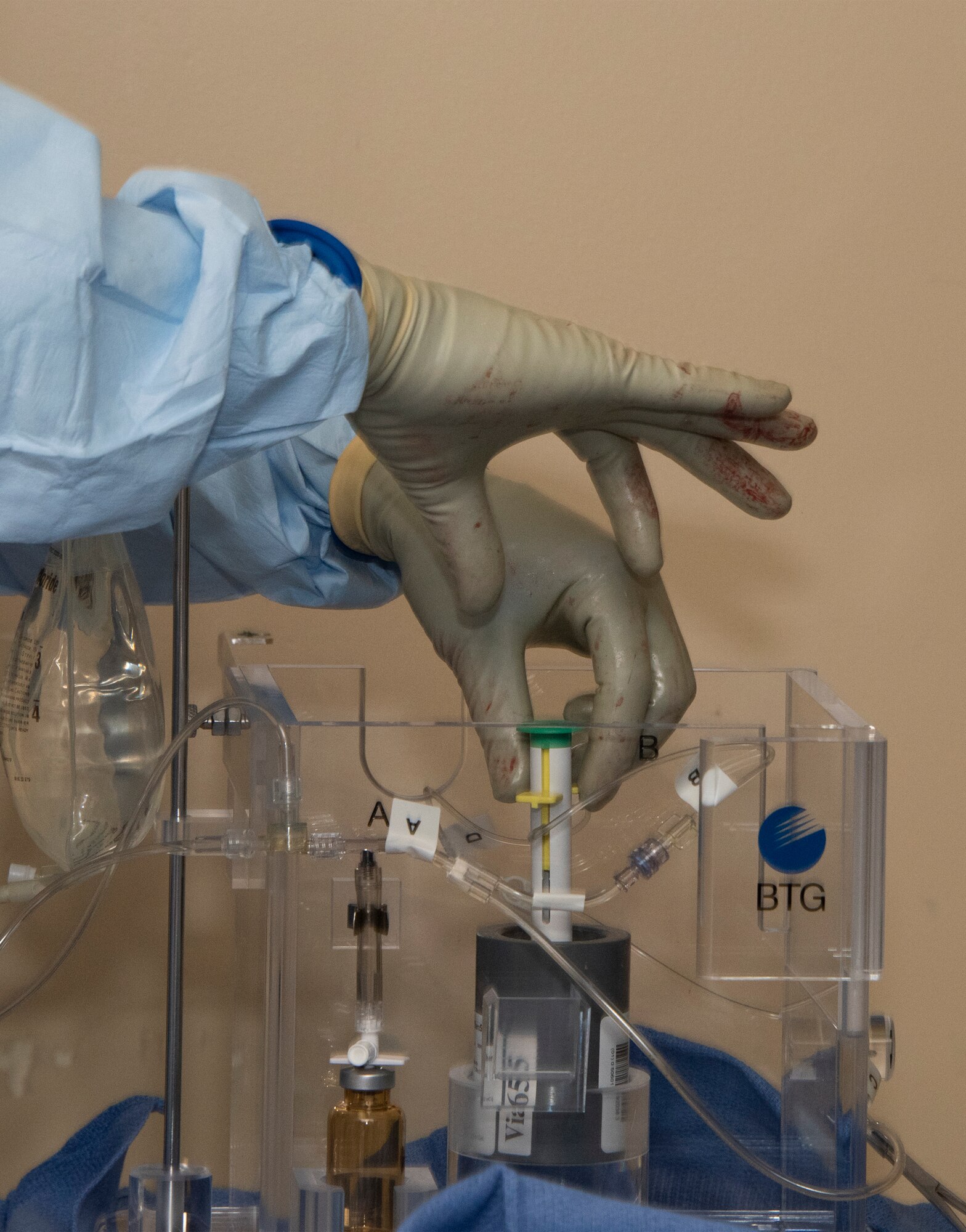 U.S. Air Force doctors prepare a high dose of Yttrium-90 radioactive beads during a procedure at David Grant U.S. Air Force Medical center, Sept. 7, 2018, Travis Air Force Base, Calif. The Y-90 radio-embolization is an advanced and minimally invasive method utilized to treat cancer by delivering millions of tiny radioactive beads inside the blood vessels that feed a tumor. The high dose of targeted radiation prospectively kills the tumor while sparing normal tissue. This was the first time the treatment was performed at DGMC. (U.S. Air Force photo by Heide Couch)