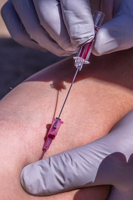 A U.S. Marine with Task Force Koa Moana inserts a peripheral venous catheter during a Combat Lifesaver (CLS) course at Marine Corps Base Camp Pendleton, Calif., Sept. 20, 2018. The CLS course taught Marines how to properly apply life-saving interventions in tactical combat situations. (U.S. Marine Corps photo by Cpl. Branden J. Bourque)