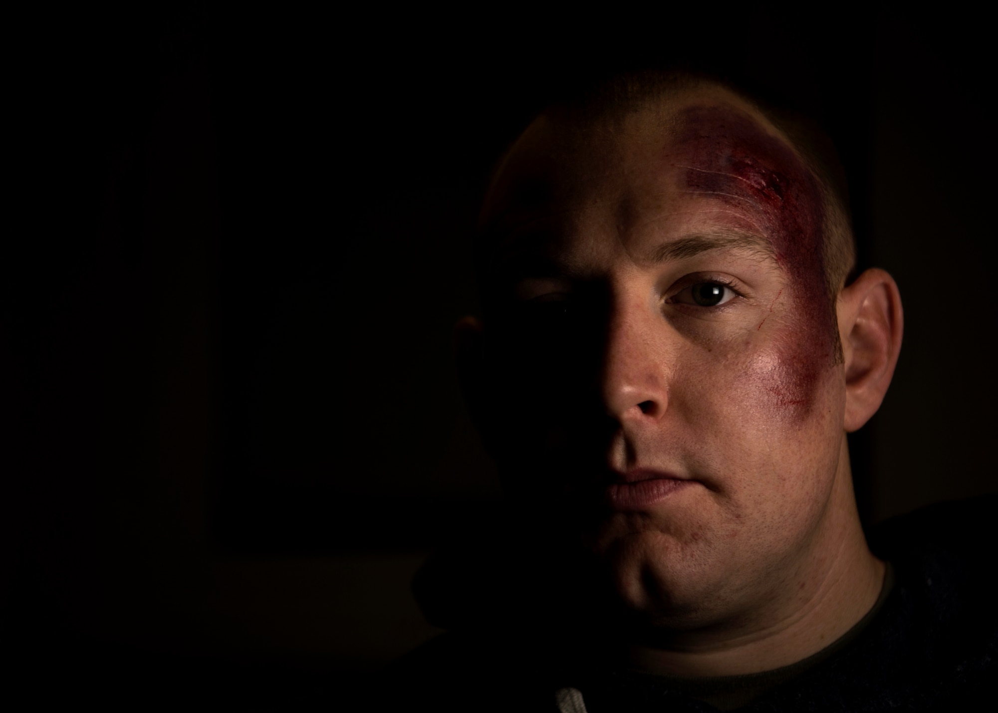 U.S. Air Force Tech. Sgt. Jeremy Lundgren, 52nd Force Support Squadron academic affairs NCO in-charge, poses for a portrait while wearing moulage makeup at Spangdahlem Air Base, Germany, Oct. 17, 2018. Lundgren volunteered to simulate a victim of domestic violence for one day in support of the Black Eye Campaign. The social experiment was designed to motivate the Spangdahlem community to ask and attend to individuals who may need help. (U.S. Air Force photo by Airman 1st Class Valerie Seelye)