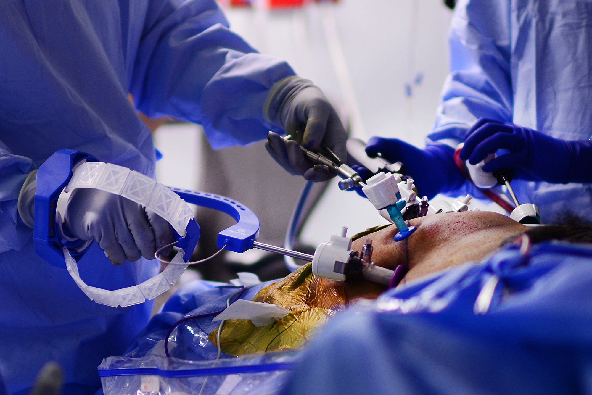 U.S. Air Force Major Richard Knight, Diplomate of the American Board of Urology, Chief of Surgery at the 48th Medical Group, uses FlexDex surgical technology to suture during a laparoscopic radical prostatectomy surgery at Royal Air Force Lakenheath, England Oct. 18, 2018. The FlexDex surgical platform precisely transforms the surgeon’s hand, wrist, and arm movements outside the patient into conforming actions of an end-effector inside the patient’s body. (U.S. Air Force photo/ Tech. Matthew Plew)