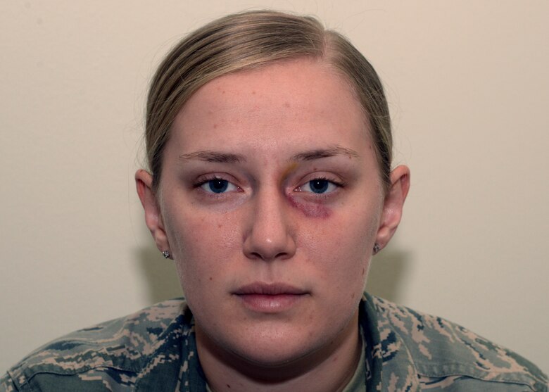 Awareness Raised Through Black Eye Campaign 59th Medical Wing