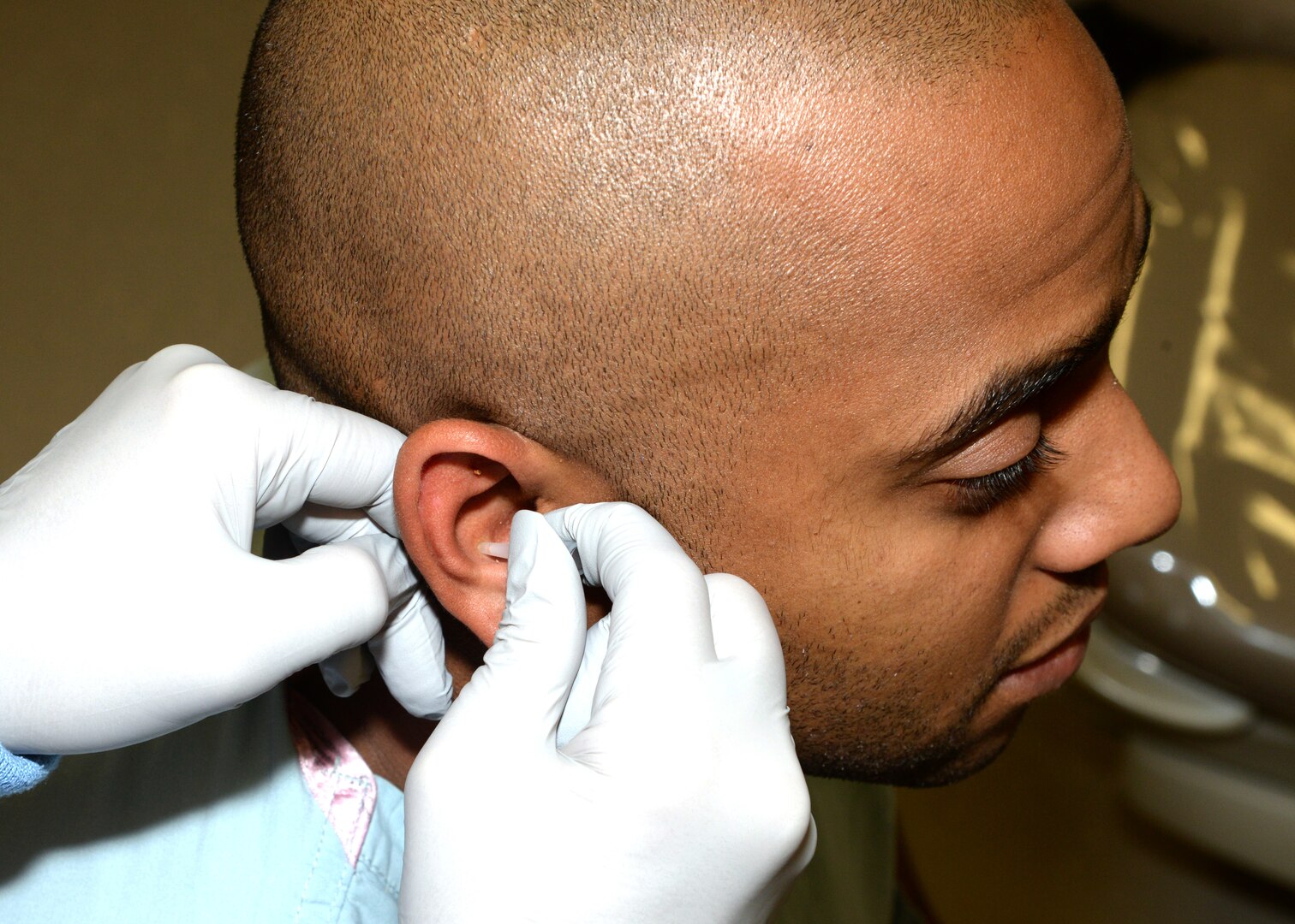 Staff Sgt. Troy Ferrell, non-commissioned officer in charge of the urology clinic at Wilford Hall Ambulatory Surgical Center on Joint Base San Antonio-Lackland, receives battlefield acupuncture treatment in his ear for his knee and back pain. The clinic offers treatments every second and fourth Wednesday of the month from 1 p.m. to 2:30 p.m. on a walk-in basis for patients who are looking for an alternative method to traditional pain management medications.