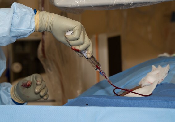 Medical personnel at David Grant USAF Medical Center conduct a Yttrium-90 radioembolization procedure for a patient with liver cancer Sept. 7, 2018 at Travis Air Force Base, Calif.  The procedure is an advanced and minimally invasive method utilized to treat cancer by delivering millions of tiny radioactive beads inside the blood vessels that feed a tumor. The high dose of targeted radiation prospectively kills the tumor while sparing normal tissue. This was the first time the treatment was performed at DGMC. (U.S. Air Force Photo by Heide Couch)