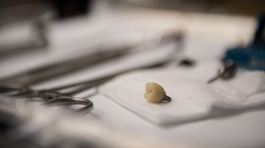 Residency program provides Airmen dental implant options