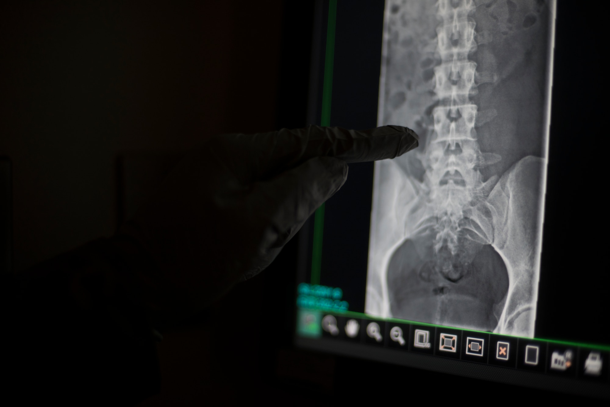 U.S. Air Force Senior Airman William Gathers, a 35th Surgical Operations Squadron radiology technician, inspects an x-ray at Misawa Air Base, Japan, April 10, 2019. Through the Continuous Process Improvement Pacific Ultrasound Peer Review program, which allows radiology U.S. Pacific Air Force technicians to quarterly select previously performed ultrasounds at random and inspect them for accuracy ensuring proper procedures and protocol were followed. (U.S. Air Force Photo by Senior Airman Collette Brooks)