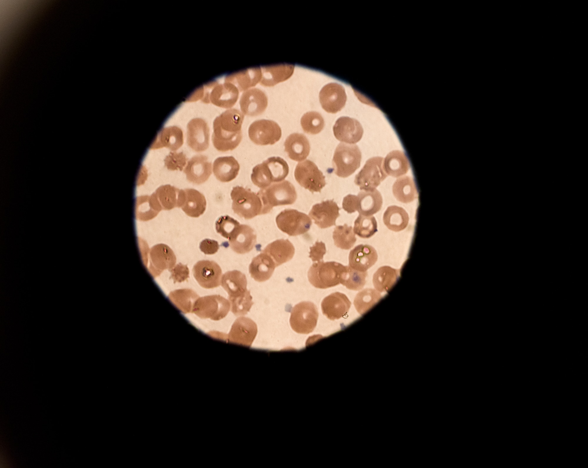 A sample rests under a microscope March 28, 2019, at Incirlik Air Base, Turkey. Besides blood samples, the 39th Medical Support Squadron tests many specimens to help diagnose patients. (U.S. Air Force photo by Staff Sgt. Matthew J. Wisher)
