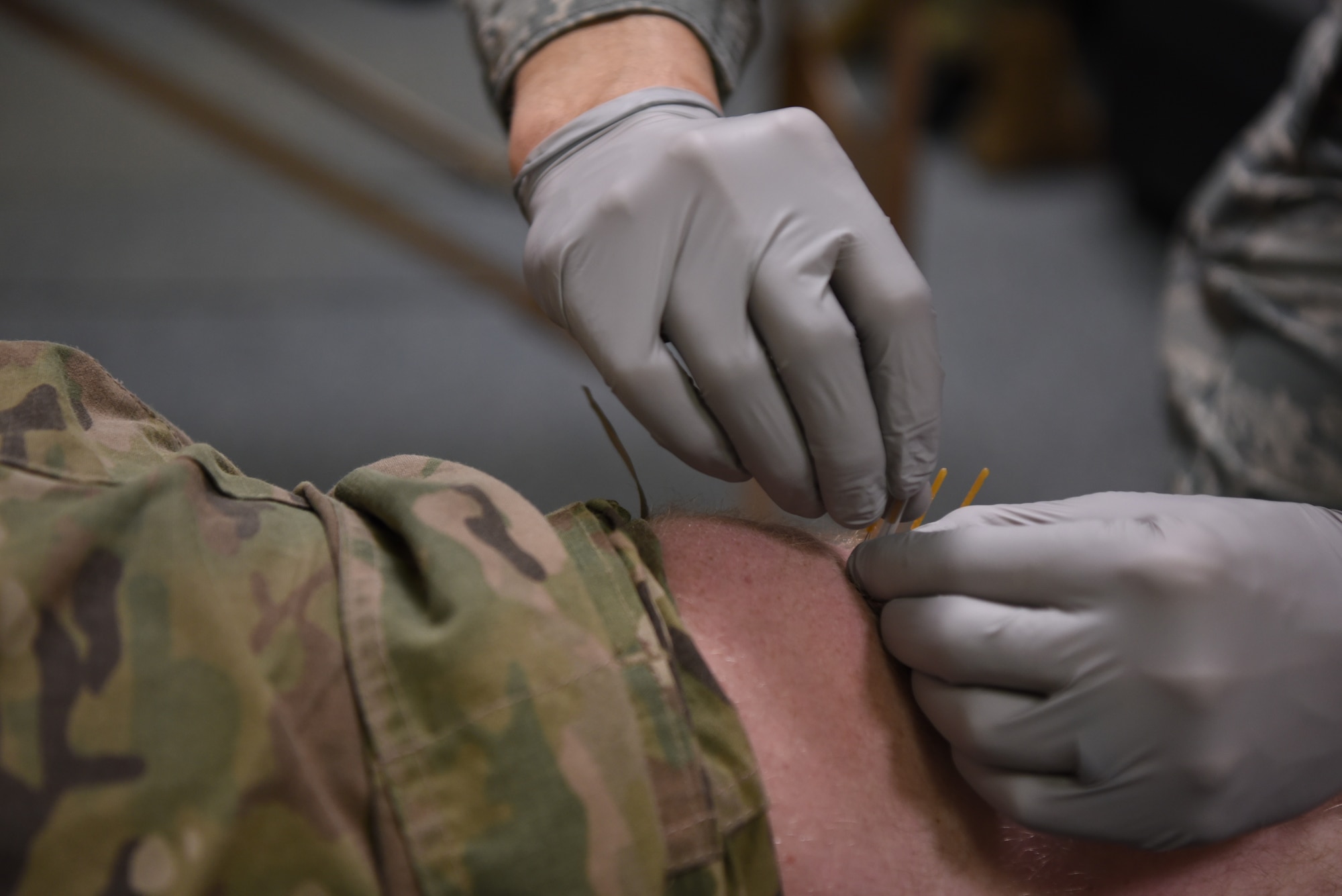 Captain Eric Walter, 90th Medical Operations Squadron physical therapy flight commander, performs dry needling on a 890th Missile Security Forces Squadron defender during a weekly squadron visit Feb. 4, 2019, at F.E. Warren Air Force Base, Wyo. The physical therapy team is equipped to handle a wide variety of injuries with various methods of treatment, including dry needling, exercises and battlefield acupuncture. The 90th MDOS PT team visits to the 890th MSFS weekly to provide in-house care before the defenders begin daily operations. (U.S. Air Force photo by Senior Airman Abbigayle Williams)