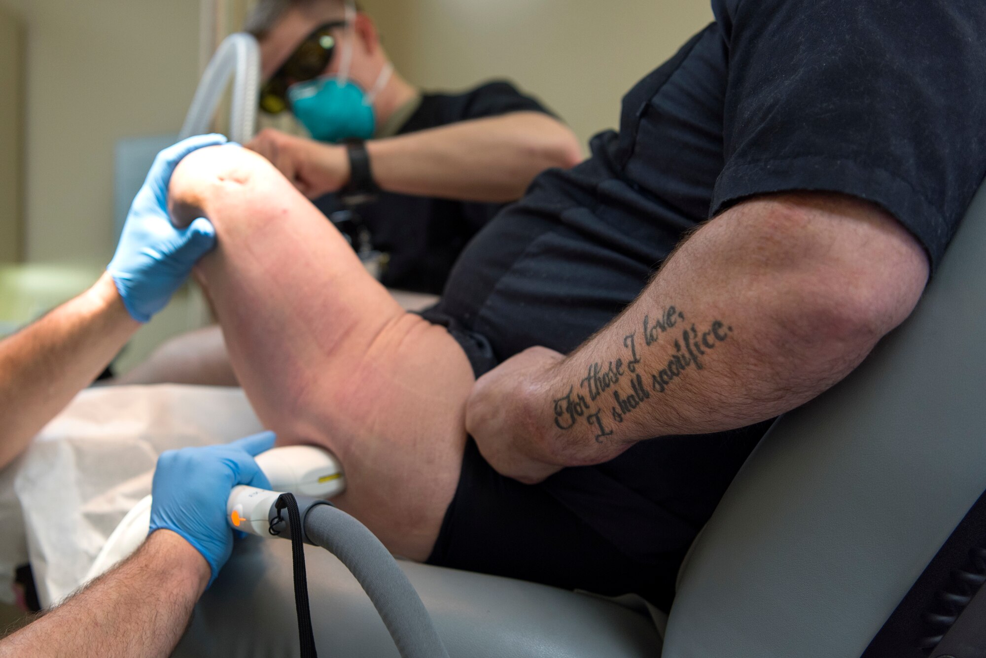 A wounded warrior receives laser treatment to improve the scar tissue of his amputated leg at the MacDill Air Force Base, Fla., scar clinic Feb. 15, 2019. The wounded-warrior-focused clinic offers a variety of treatments for those who suffer from scarring as a result of blast injuries, burns, amputations, and other surgeries.