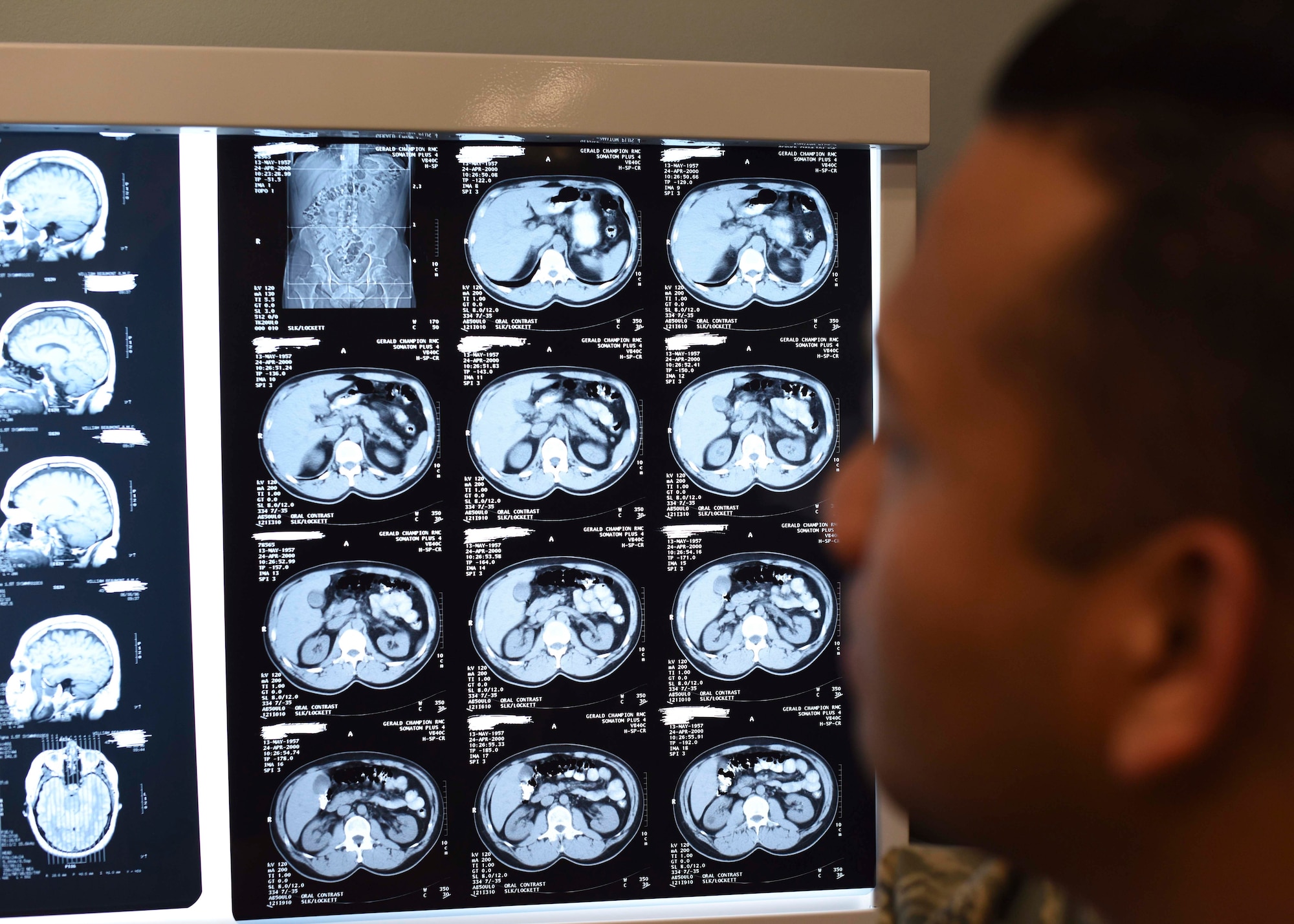 Staff Sgt. Englebert Delena, 49th Medical Group diagnostic imaging technologist, analyzes magnetic resonance imaging and computerized tomography prints, Jan. 23, 2019, on Holloman Air Force Base, N.M. The 49th Medical Group’s Radiology Clinic processes up to 2,000 patients annually, and digitally transmits x-ray images to radiologists at Travis Air Force Base, Calif., for diagnosing. (U.S. Air Force photo by Staff Sgt. BreeAnn Sachs)