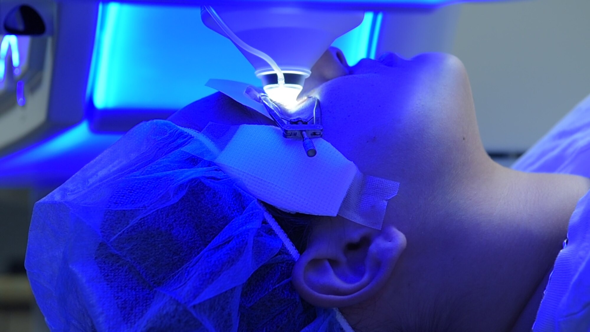 A patient receives small incision lenticule extraction treatment at the Joint Warfighter Refractive Surgery Center, Wilford Hall Ambulatory Surgical Center, Jan. 15, 2019. SMILE treatment is one of three laser surgeries performed to enhance a warfighter’s vision. Surgeons at WHASC Joint Warfighter Refractive Surgery Center executed the center’s 50,000th surgery since opening in 2000. (U.S. Air Force photo by Airman 1st Class Ryan Mancuso)