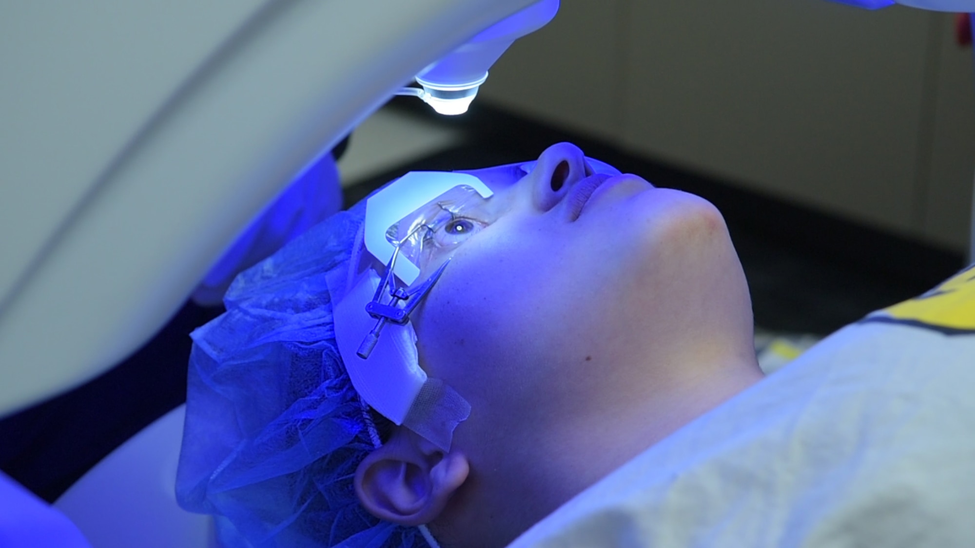 A patient receives small incision lenticule extraction treatment at the Joint Warfighter Refractive Surgery Center, Wilford Hall Ambulatory Surgical Center, Jan. 15, 2019. SMILE treatment is one of three laser surgeries performed to enhance a warfighter's vision. Surgeons at WHASC Joint Warfighter Refractive Surgery Center executed the center's 50,000th surgery since its opening in 2000. (U.S. Air Force photo by Airman 1st Class Ryan Mancuso)