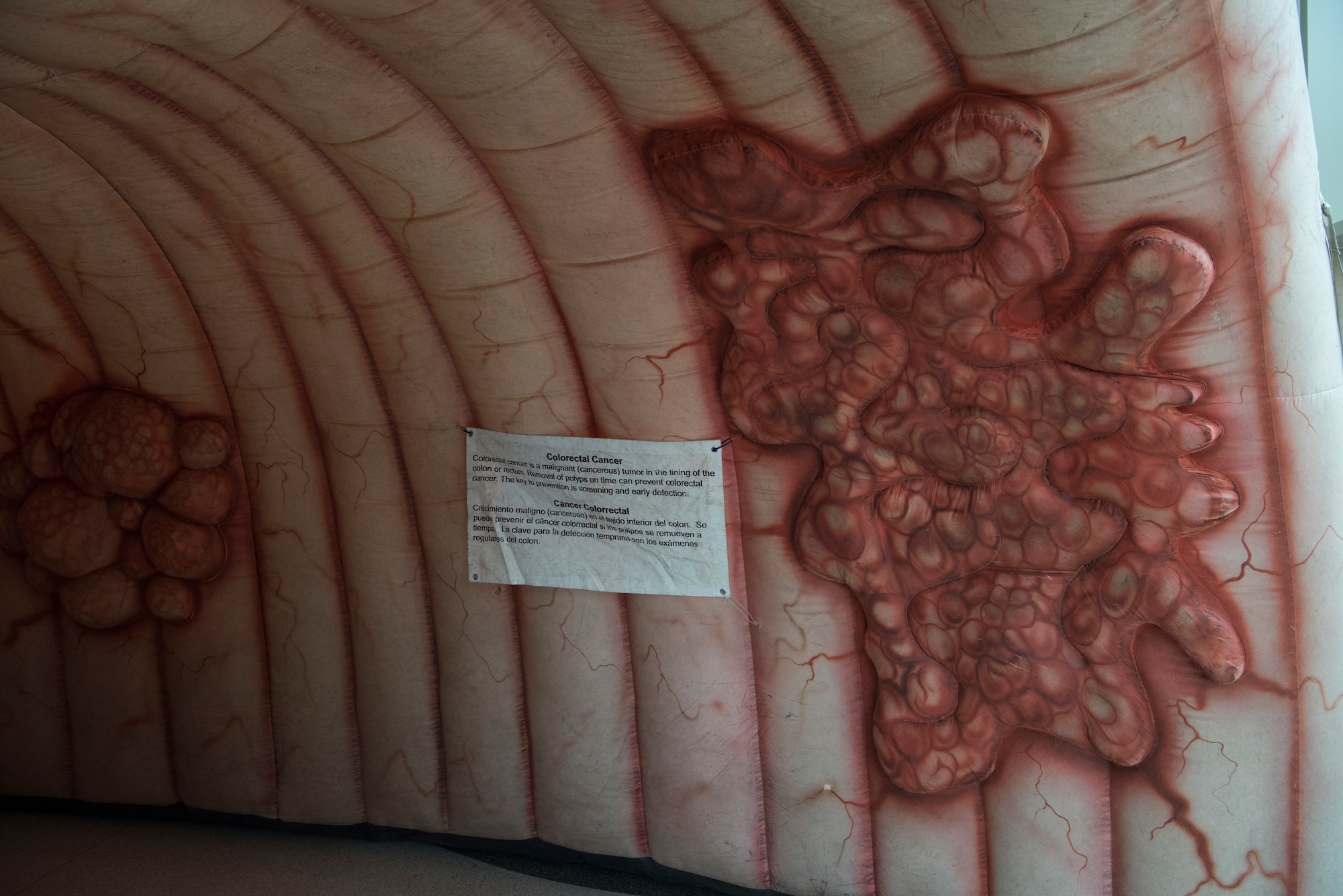 New Mexico State University’s Cancer Outreach program partners with the 49th Medical Group
to increase colorectal cancer awareness, March 7, 2019, in the medical clinic on Holloman Air
Force Base, N.M. The Cancer Outreach’s giant inflatable colon provided visual representation of
colorectal cancer. At stage four, colorectal cancer has only a 6-10 percent survival rate based on
five years. (U.S. Air Force photo by Airman 1st Class Autumn Vogt)