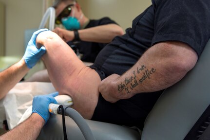 A wounded warrior receives laser treatment to improve the scar tissue of his amputated leg at the MacDill Air Force Base, Florida, scar clinic Feb. 15, 2019. The wounded-warrior-focused clinic offers a variety of unique treatments for those who suffer from scarring as a result of blast injuries, burns, amputations, and other surgeries.
