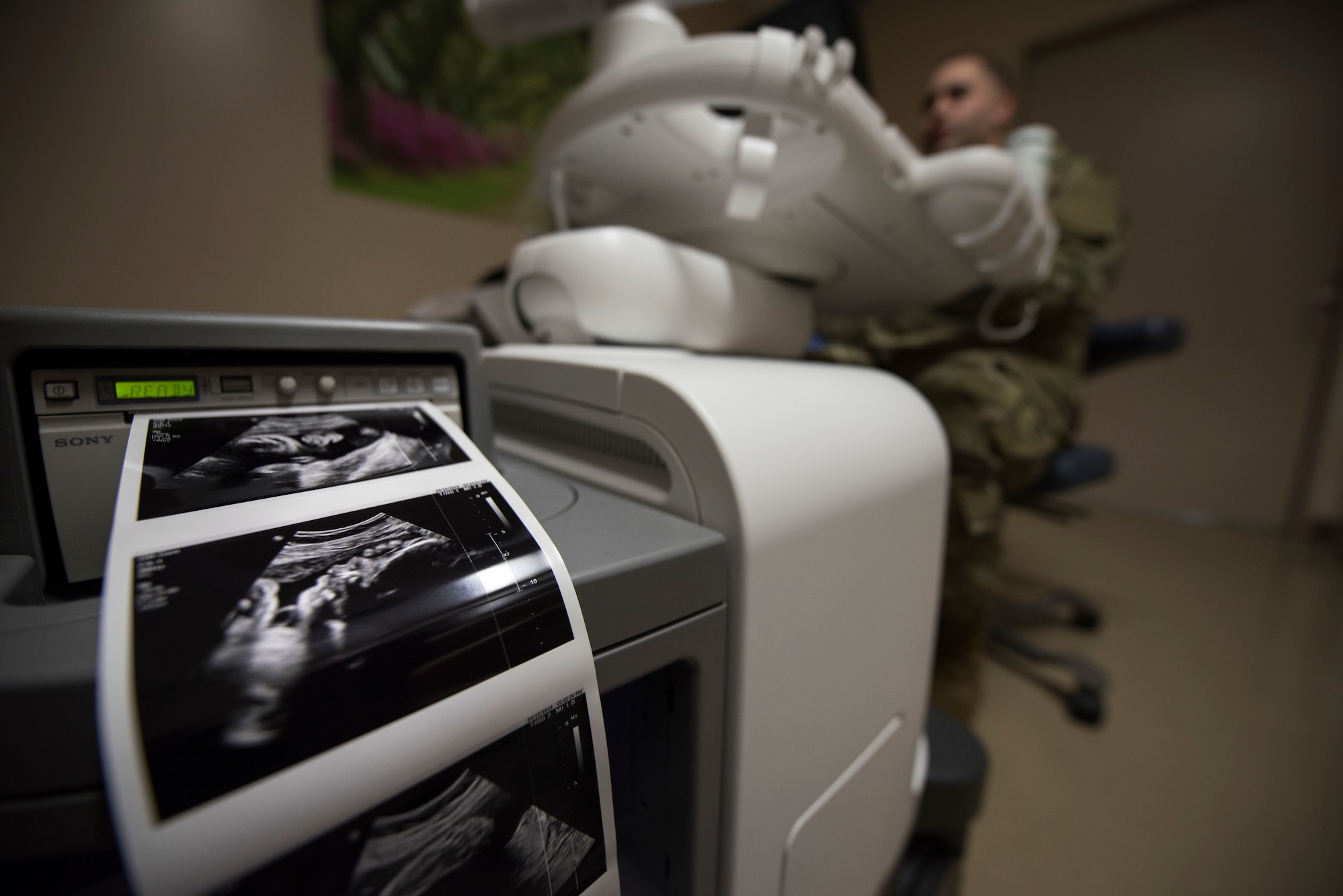 A Sony digital graphic printer prints ultrasound photos while U.S. Air Force Staff Sgt. Nance Pea, the 35th Surgical Operations Squadron ultrasound NCO in charge, conducts an ultrasound at Misawa Air Base, Japan, April 10, 2019. Patients receive photos after the exam so they can take photos home and share with their loved ones. (U.S. Air Force photo by Senior Airman Collette Brooks)