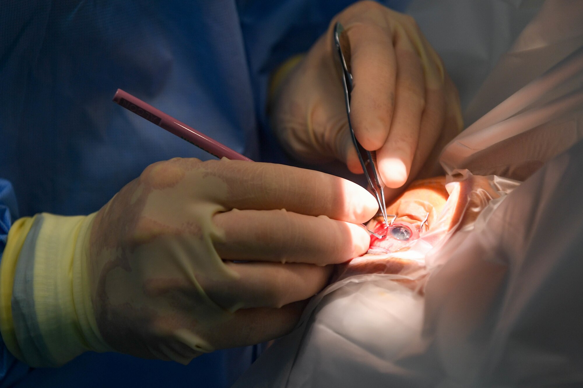 A U.S. service member performs cataract surgery to a Guyanese patient during New Horizons exercise 2019 at Port Mourant, Guyana, May 6, 2019. The ophthalmology clinic was established to provide aid to the Guyanese population by screening and selecting patients to receive cataract surgery in support of New Horizons 2019. The New Horizons exercise 2019 provides U.S. military members an opportunity to train for an overseas deployment and the logistical requirements it entails. The exercise promotes bilateral cooperation by providing opportunities for U.S. and partner nation military engineers, medical personnel and support staff to work and train side by side. (U.S. Air Force photo by Senior Airman Derek Seifert)