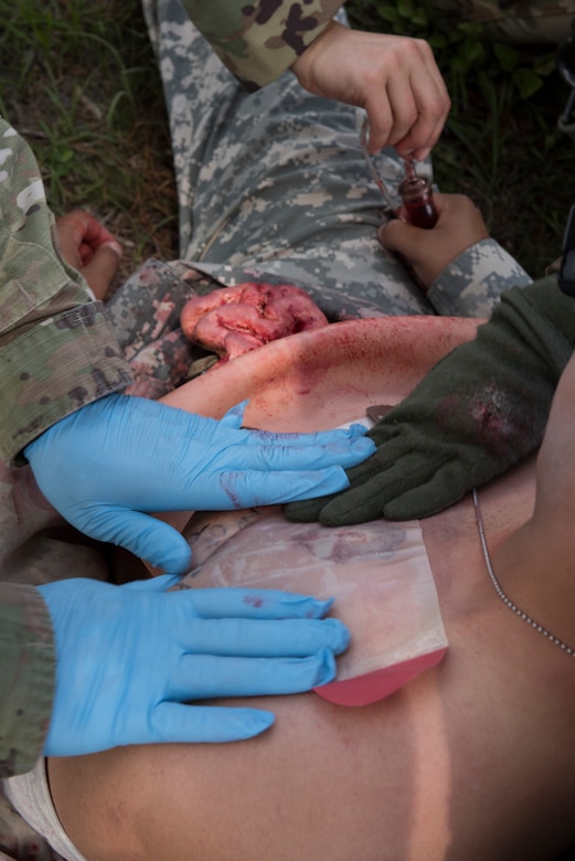 U.S. Army medics apply pressure to a simulated open-chest wound to control bleeding during a search and rescue exercise, May 21, 2019, in Comayagua, Honduras. Members from various units on Joint Task Force – Bravo participated in the exercise that simulated a HH-60 Blackhawk crashed during a routine flight carrying personnel. The exercise practiced notification, recall, search and rescue, on-scene medical care, recovery of personnel from low and high angle austere terrain, and medical care once the injured returned to base. (U.S. Air Force photo by Staff Sgt. Eric Summers Jr.)