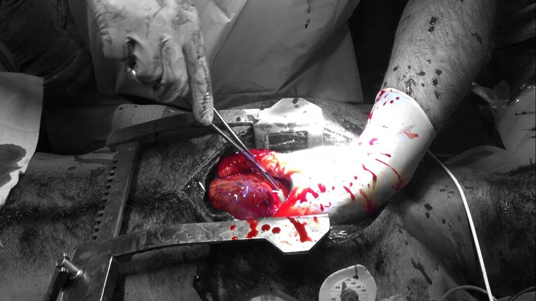 Mobile surgical specialists devoted to saving lives, anywhere and anytime.