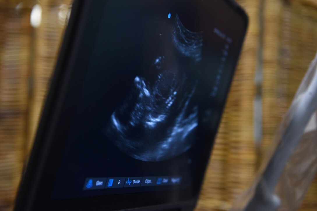 The Village Friends OB Care program performs sonograms to monitor fetal growth at Royal Air Force Lakenheath, England, Oct. 25, 2019. The program based off the Department of Defense Purple Book and the Centering Pregnancy program which was initiated at the Liberty Wing in November 2012. (U.S. Air Force photo by Airman 1st Class Rhonda Smith)