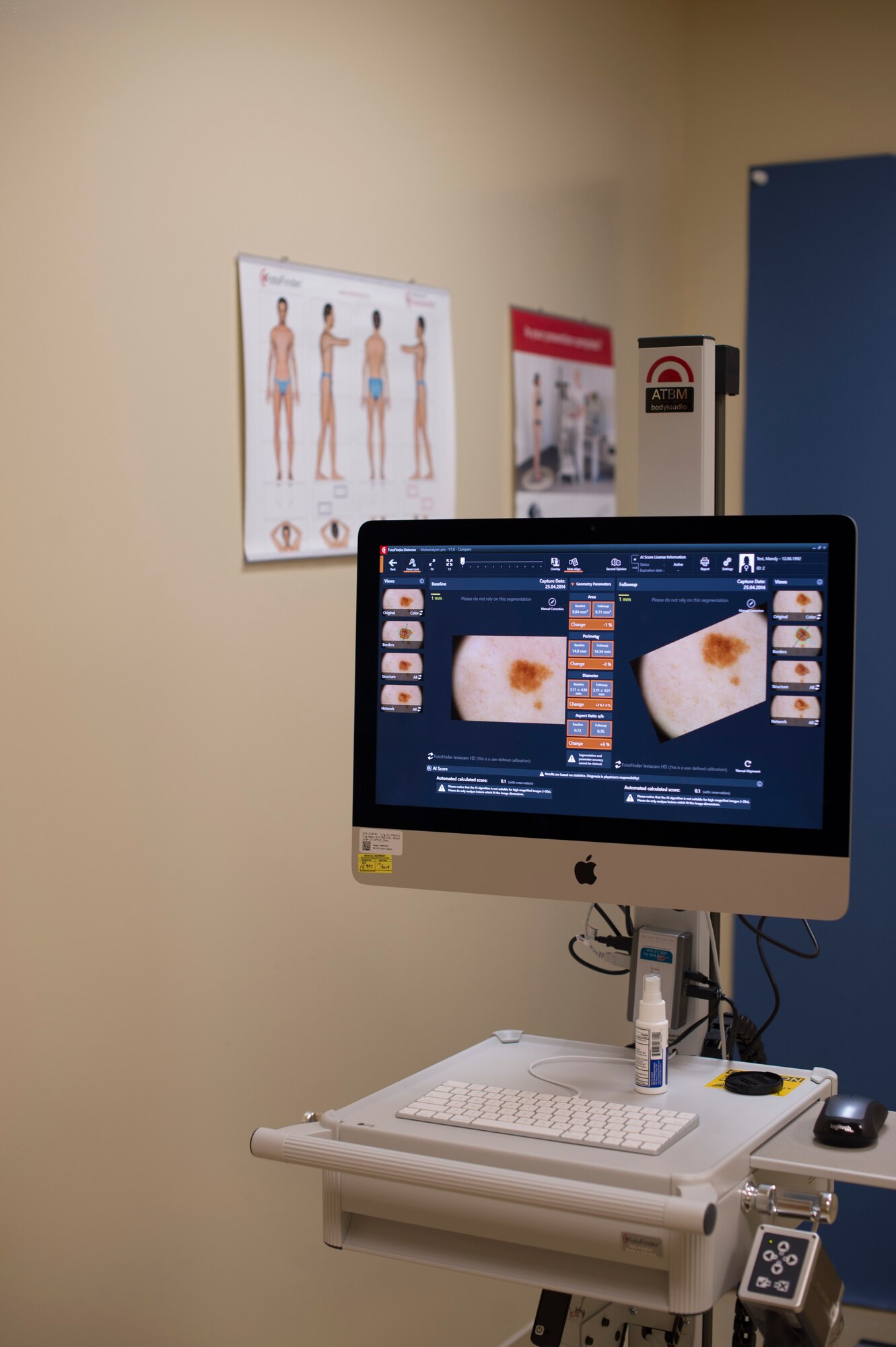 A dermatology body scanner displays an image of a test skin lesion at MacDill Air Force Base, Fla., Oct. 30, 2019. A new software upgrade allows a complex algorithm to scan an image captured with a camera and rate the severity of the spot for a dermatologist to review. (U.S. Air Force photo by Senior Airman Adam R. Shanks)