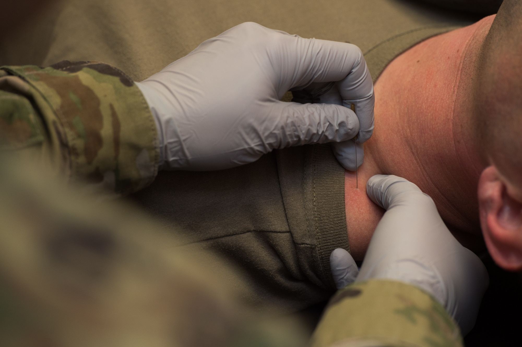 U.S. Air Force Capt. Michelle Jilek, 633rd Medical Operations Squadron physical therapist, performs dry needling on Maj. Seth Rumbarger, 71st Fighter Squadron T-38 Talon pilot, at Joint Base Langley Eustis, Virginia, Nov. 13, 2019.