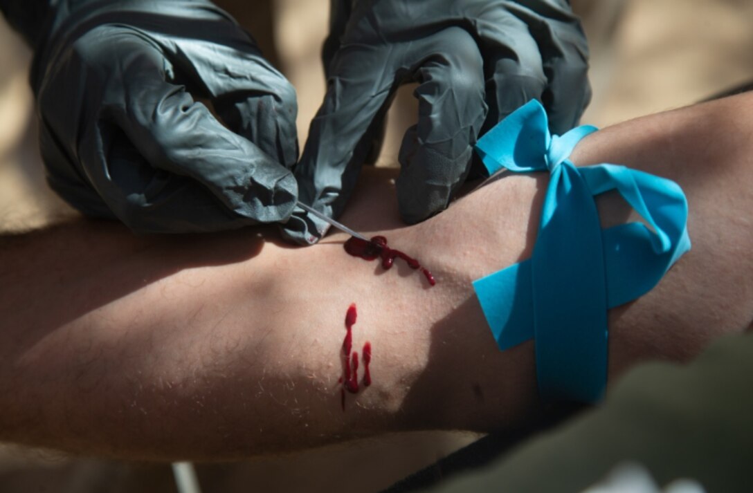Fresh Blood Transfusion