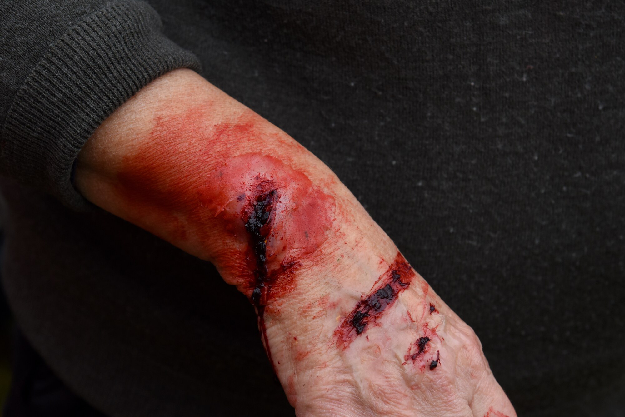 A volunteer from the Suffolk Lowlands Search and Rescue organization shows fake wound in Thetford, England, Nov. 23, 2019. Volunteers from SuLSAR worked alongside medical military personnel from Royal Air Force Lakenheath, RAF Mildenhall, and RAF Alconbury in a joint exercise. U.S. Air Force Medical Airmen participating in the exercise had the opportunity to enhance medical readiness through an interactive scenario. (U.S. Air Force photo by Airman 1st Class Rhonda Smith)
