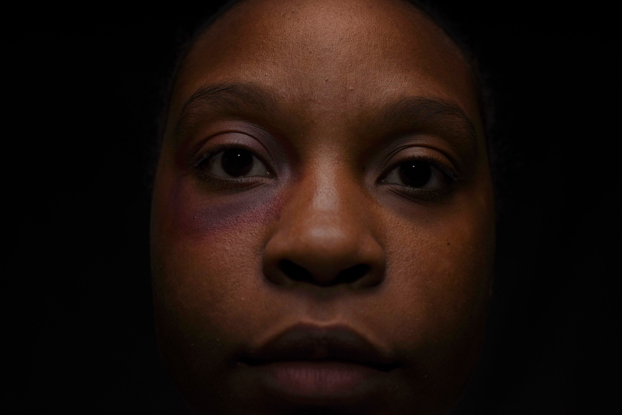 U.S. Air Force Staff Sgt. Ceaira Tinsley, 39th Air Base Wing non-commissioned officer in charge of command information, wears makeup simulating a bruise during a domestic violence awareness exercise Oct. 10, 2019, at Incirlik Air Base, Turkey. Ten Airmen from various units wore artificial scars on their faces to see what kind of reactions they would receive from their colleagues around the installation. (U.S. Air Force photo by Staff Sgt Joshua Magbanua)