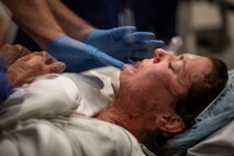 Col. (Dr.) Chad Hivnor, 59th Medical Specialty Squadron laser medicine chief, applies a salve to the burned skin of retired U.S. Army Capt. Katie Blanchard after surgery