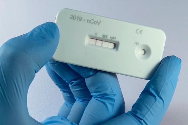 A scientist presents an antibody test for coronavirus in a laboratory of the Leibniz Institute of Photonic Technology (Leibniz IPHT) at the InfectoGnostics research campus in Jena, Germany, Friday, April 3, 2020. An international team of researchers with the participation of the Jena Leibniz Institute of Photonic Technology (Leibniz IPHT) has developed a rapid antibody test for the new coronavirus. By means of a blood sample, the test shows within ten minutes whether a person is acutely infected with the SARS-CoV-2 virus (IgM antibody) or already immune to it (IgG antibody). The strip test is manufactured by the diagnostics company Senova in Weimar and is already on the market. For most people, the new coronavirus causes only mild or moderate symptoms, such as fever and cough. For some, especially older adults and people with existing health problems, it can cause more severe illness, including pneumonia. (AP Photo/Jens Meyer)